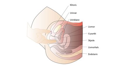 1kvinne2-1030x618